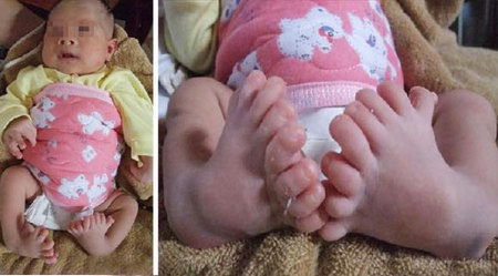 16toes.jpg