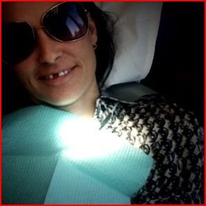 demi-moore-missing-tooth.JPG
