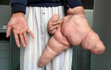 largesthand.jpg