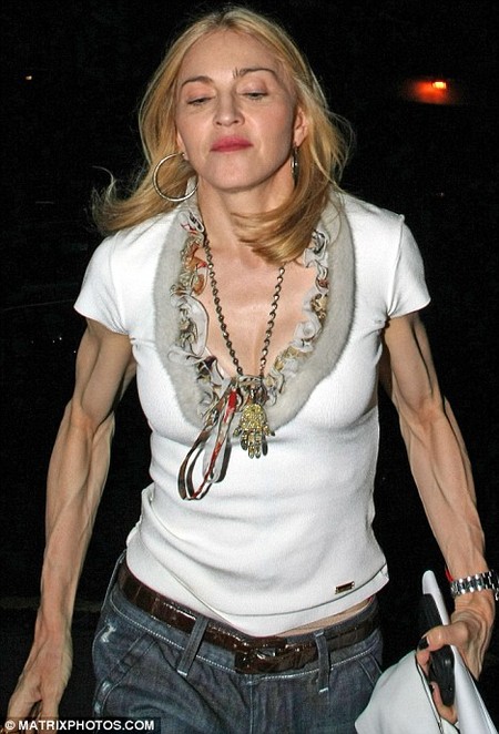 madonna-scary-arms.jpg
