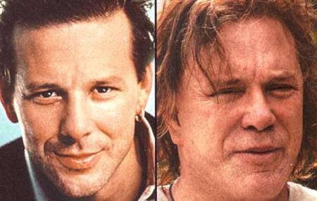 mickey-rourke-plastic-surgery.jpg