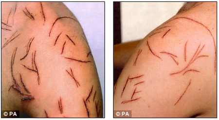 scars.png