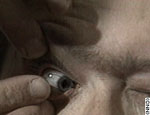 contact lense insert