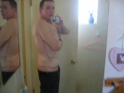 fat-surgery-07.jpg