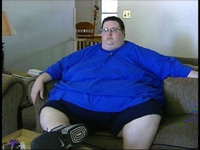 fat-surgery-08.jpg