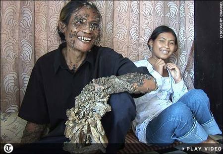 tree-man-01.jpg