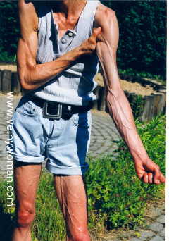 veiny-woman.jpg