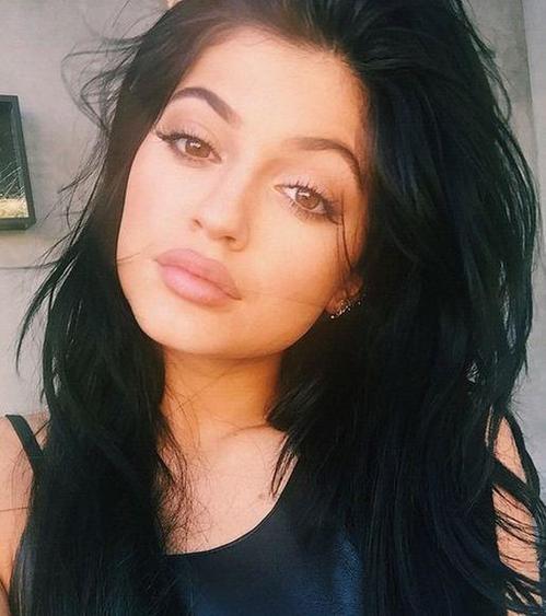 kylie-jenners-rumored-lip-injections-spark-talk.JPG