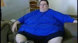 fat-surgery-08.jpg