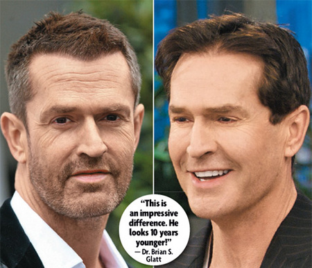 rupert-everett-surgery-thumb.jpg