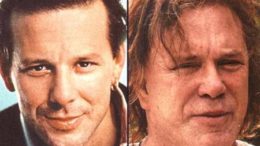mickey-rourke-plastic-surgery-thumb.jpg